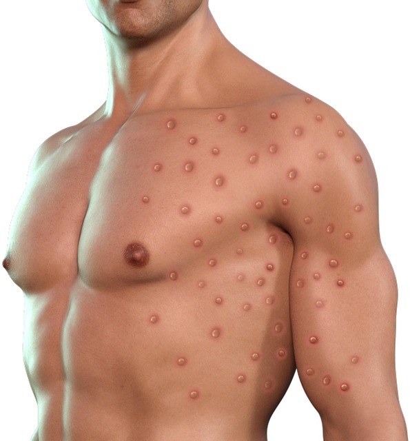 Dělali jste test na koronavirus?